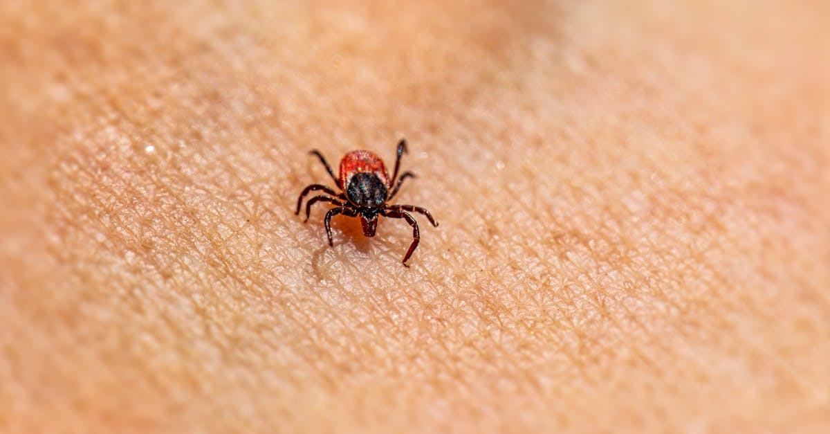 découvrez des solutions efficaces pour soulager rapidement les démangeaisons et l'inconfort causés par les piqûres d'insectes. profitez de nos conseils et remèdes naturels pour apaiser votre peau et retrouver le bien-être.