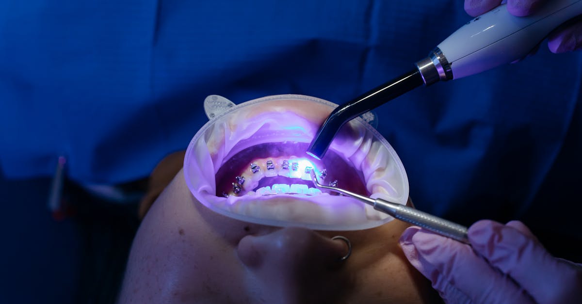découvrez notre dentifrice blanchissant, conçu pour éclaircir votre sourire tout en protégeant votre émail. profitez d'une formule innovante qui élimine les taches et apporte fraîcheur à votre haleine. obtenez des résultats visibles et un sourire éclatant dès la première utilisation!