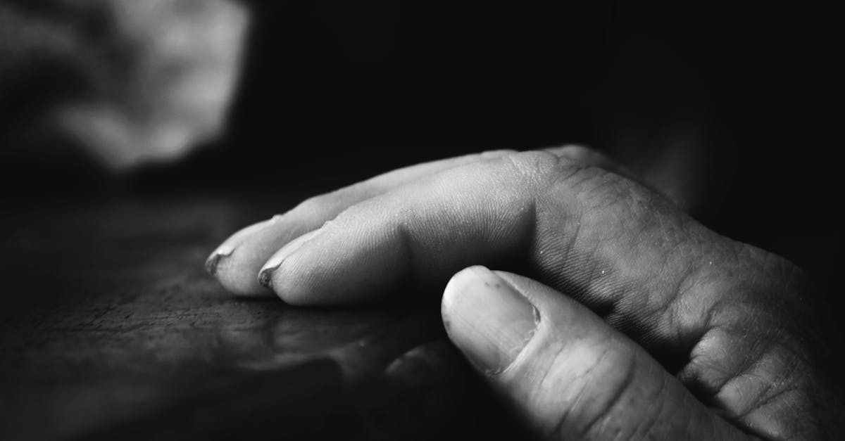découvrez tout ce qu'il faut savoir sur les acrochordon, ou 'skin tags'. apprenez les causes, les méthodes de prévention et les options de traitement pour ces petites protrusions cutanées inoffensives.
