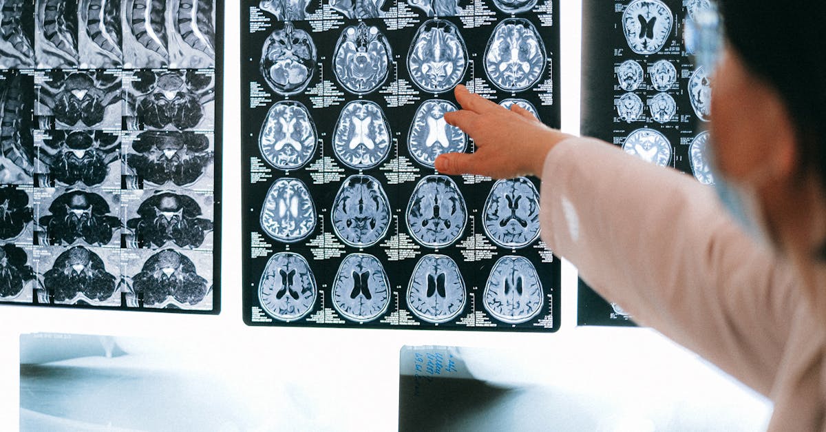 découvrez les aliments qui stimulent votre cerveau et améliorent vos fonctions cognitives. apprenez à intégrer des 'brain foods' dans votre alimentation pour favoriser la concentration, la mémoire et le bien-être mental.