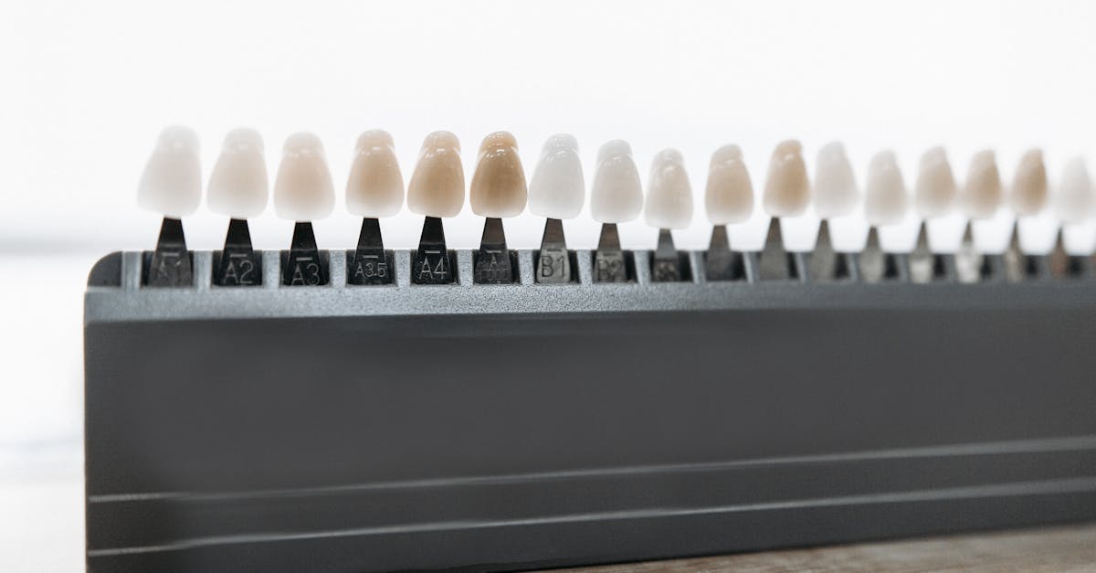 découvrez notre guide complet sur le blanchiment des dents : méthodes, astuces et conseils pour un sourire éclatant. apprenez à choisir la meilleure option de blanchiment selon vos besoins et retrouvez confiance en votre sourire.