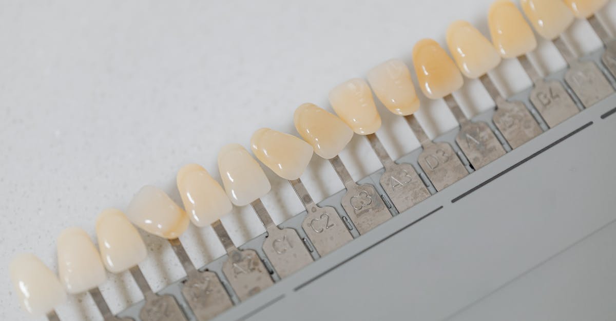découvrez les meilleures méthodes de blanchiment dentaire pour un sourire éclatant. apprenez des conseils pratiques et des astuces pour obtenir des dents plus blanches et en meilleure santé.