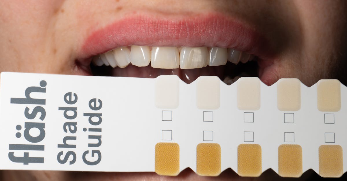 découvrez notre guide complet sur le blanchiment des dents : conseils, techniques et produits efficaces pour obtenir un sourire éclatant et sain. transformez votre sourire en toute sécurité et en toute confiance!