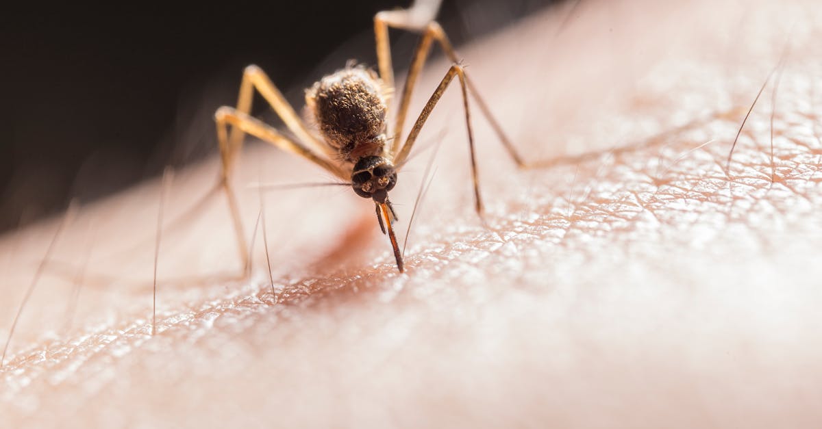 découvrez les causes, symptômes et traitements des infections urinaires. apprenez à prévenir ces affections courantes et à améliorer votre santé urinaire grâce à des conseils pratiques et des remèdes efficaces.